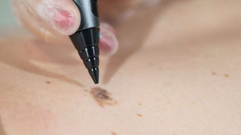 Dermatology Services